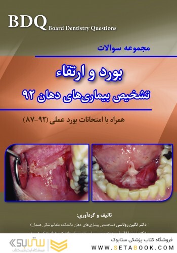 BDQ مجموعه سوالات تفکیکی بورد و ارتقاء تشخیص بیماری های دهان 92