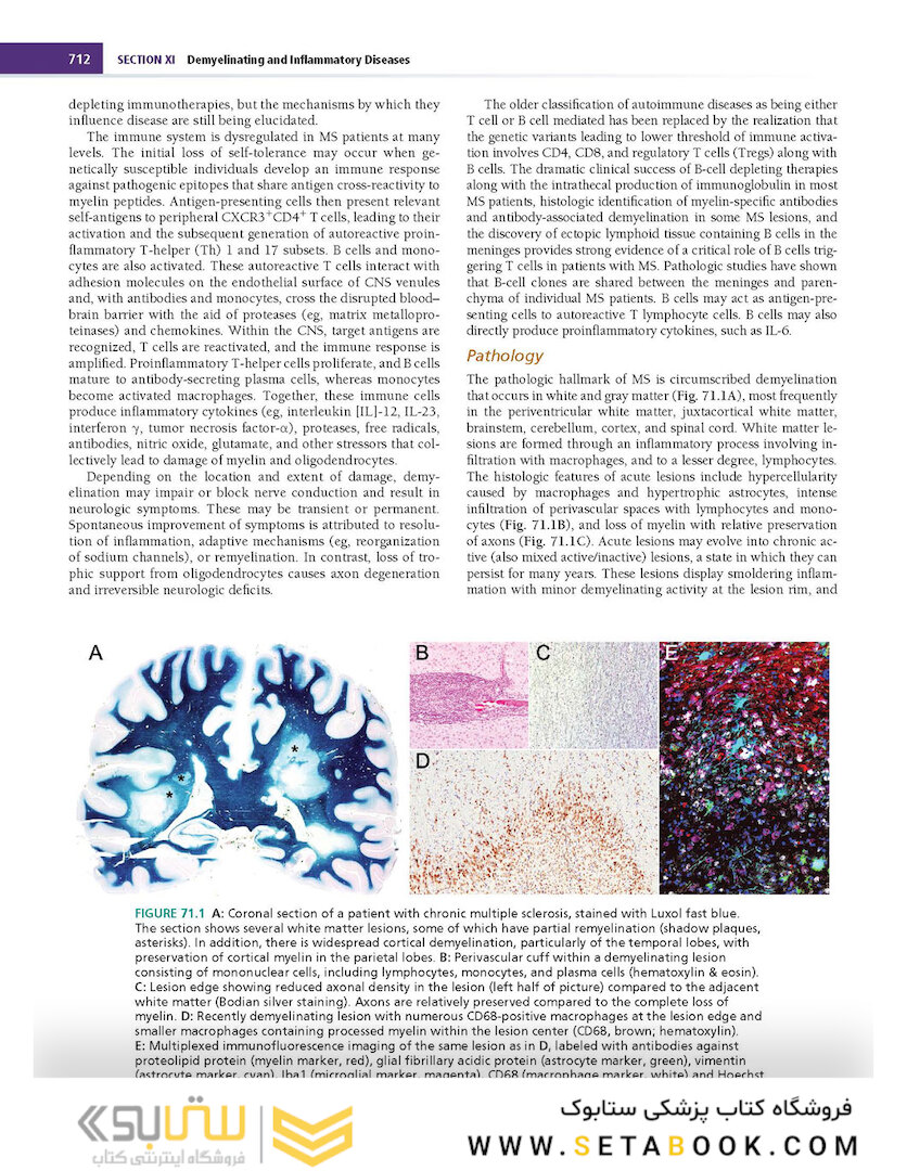 Merritt’s Neurology Fourteenth Edition