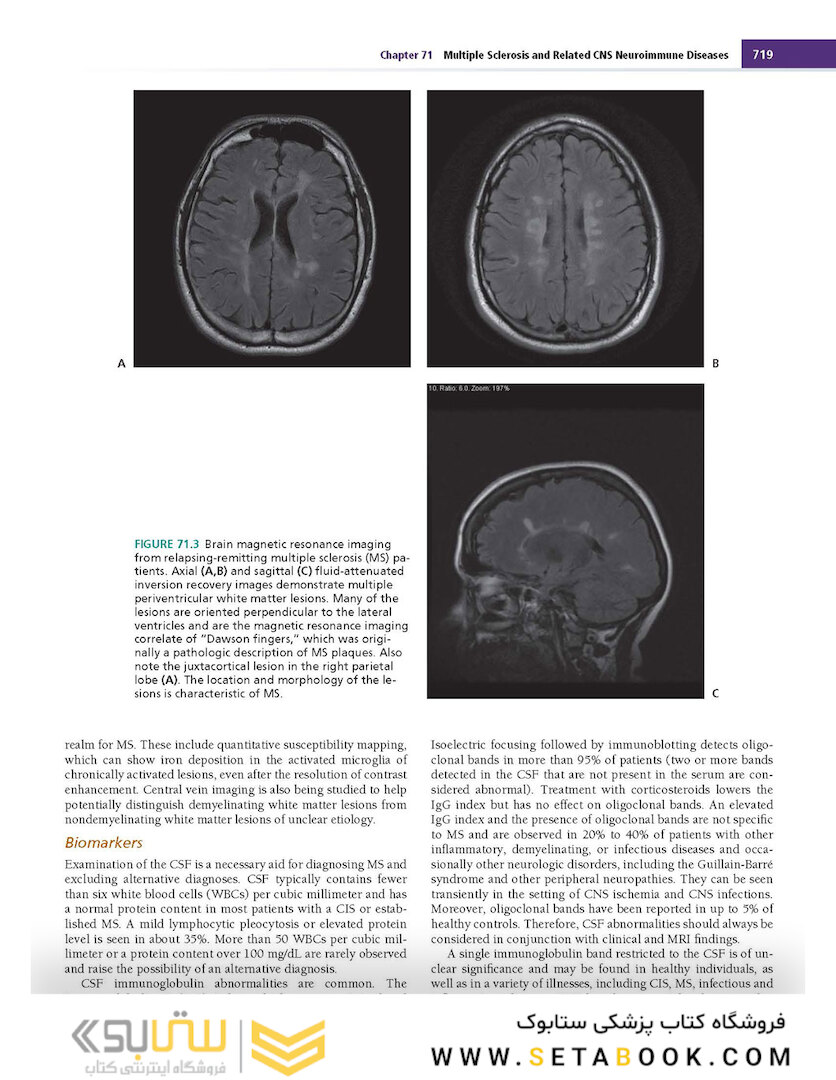 Merritt’s Neurology Fourteenth Edition