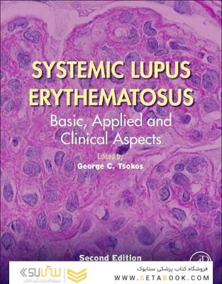 Systemic Lupus Erythematosus : Basic, Applied and Clinical Aspects