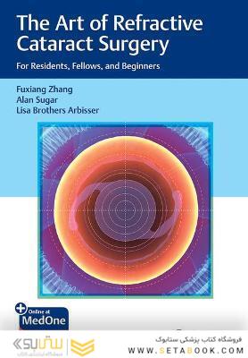 The Art of Refractive Cataract Surgery: For Residents, Fellows, and Beginners 1st Edition,