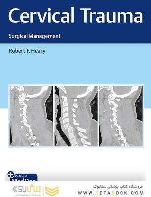 Cervical Trauma: Surgical Management 1st Edition