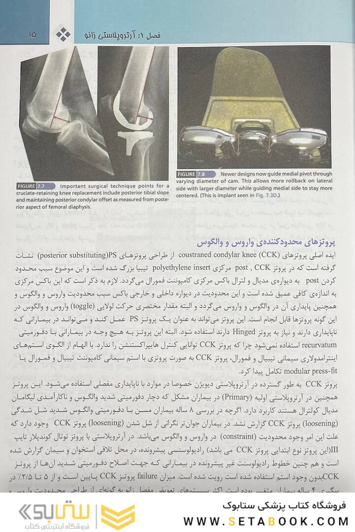 جراحی ارتوپدی زانو کمپل 2021