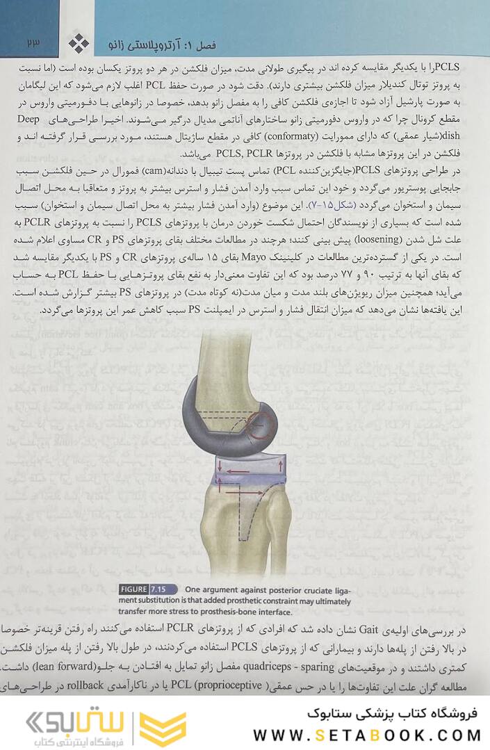 جراحی ارتوپدی زانو کمپل 2021