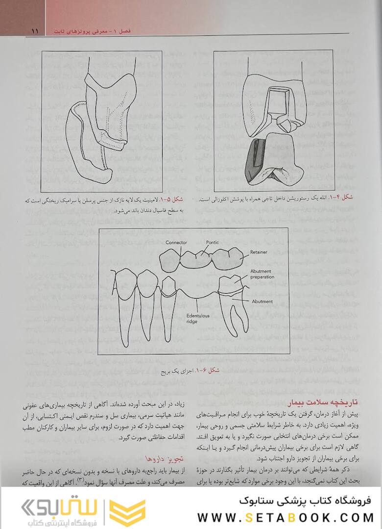 مبانی پروتز های ثابت شیلینبرگ 2012