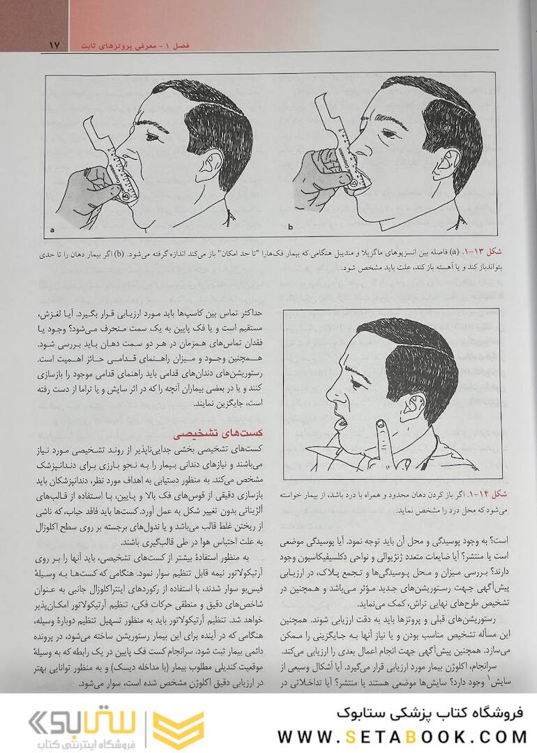 مبانی پروتز های ثابت شیلینبرگ 2012