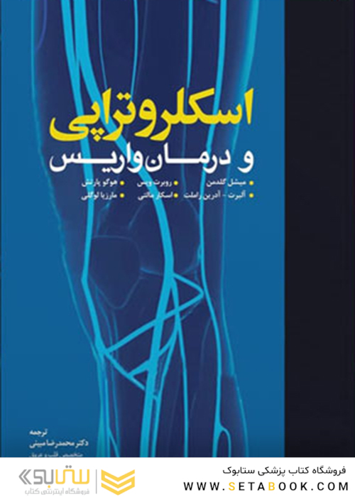 اسکلروتراپی و درمان واریس