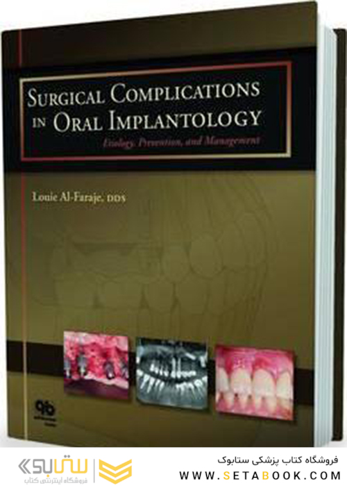 Surgical Complications in Implantology