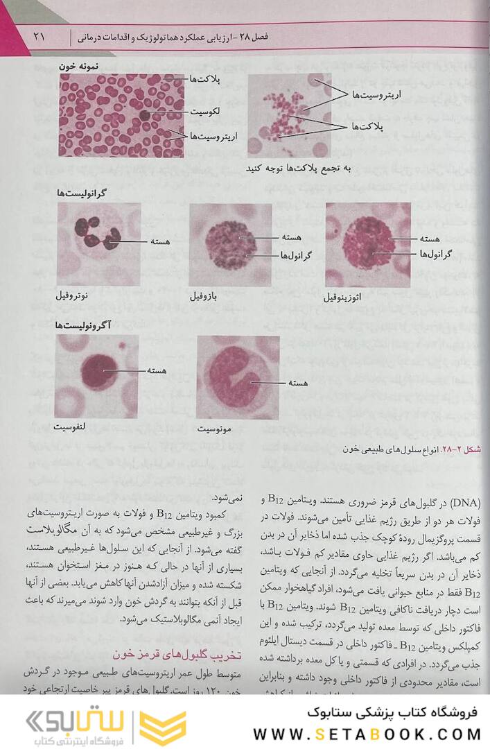 پرستاری داخلی جراحی برونر خون 2022 جلد 6