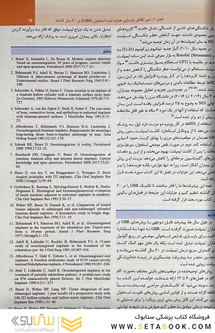 بازسازی استخوان هدایت شده در طی 30 سال