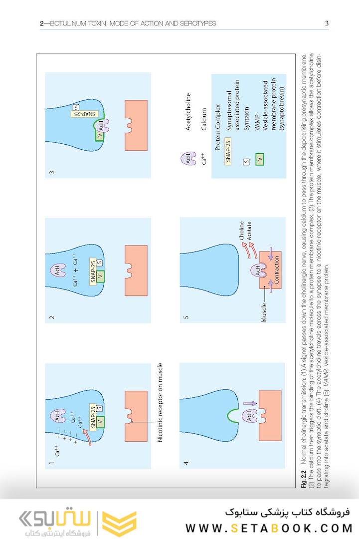 Botulinum Toxin in Facial Rejuvenation 2nd Edición