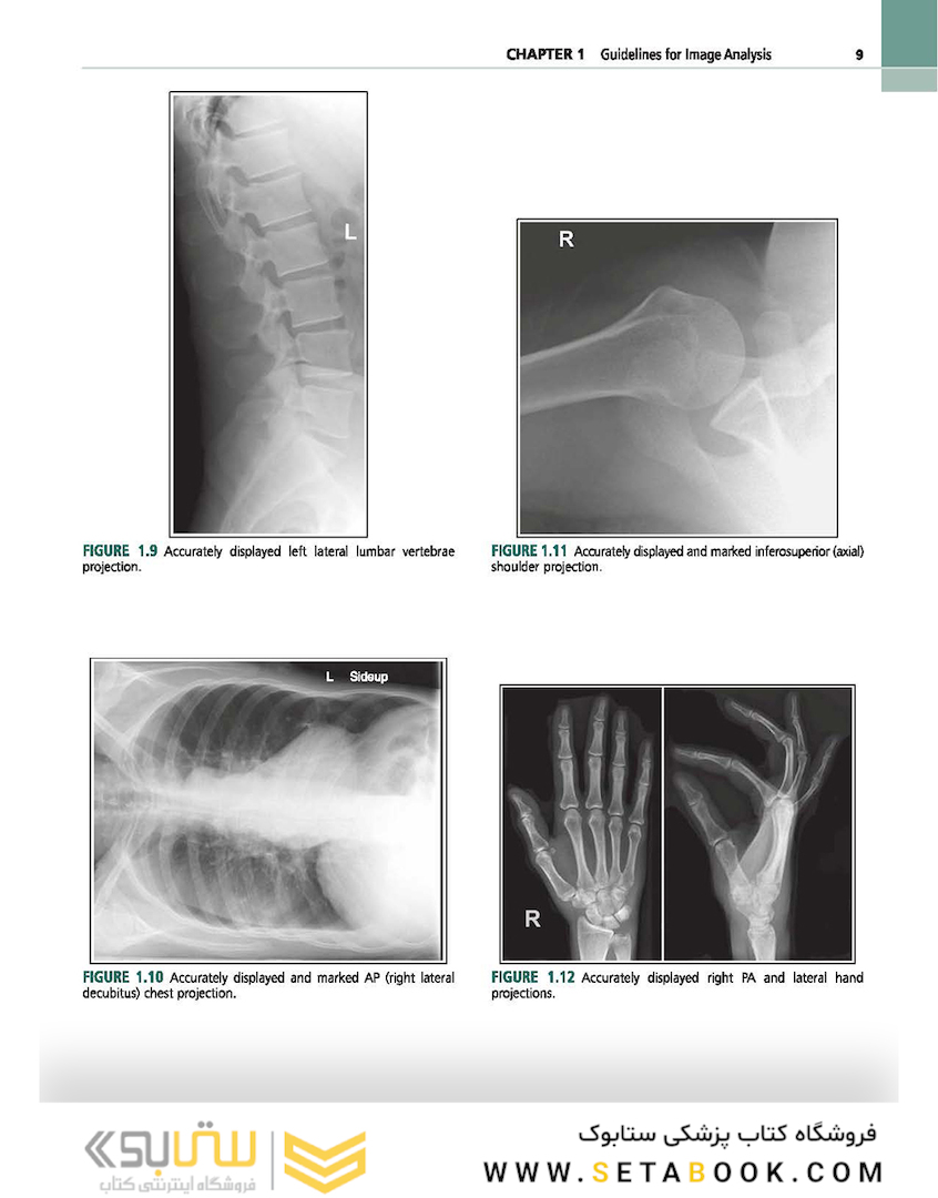 Radiographic Image Analysis