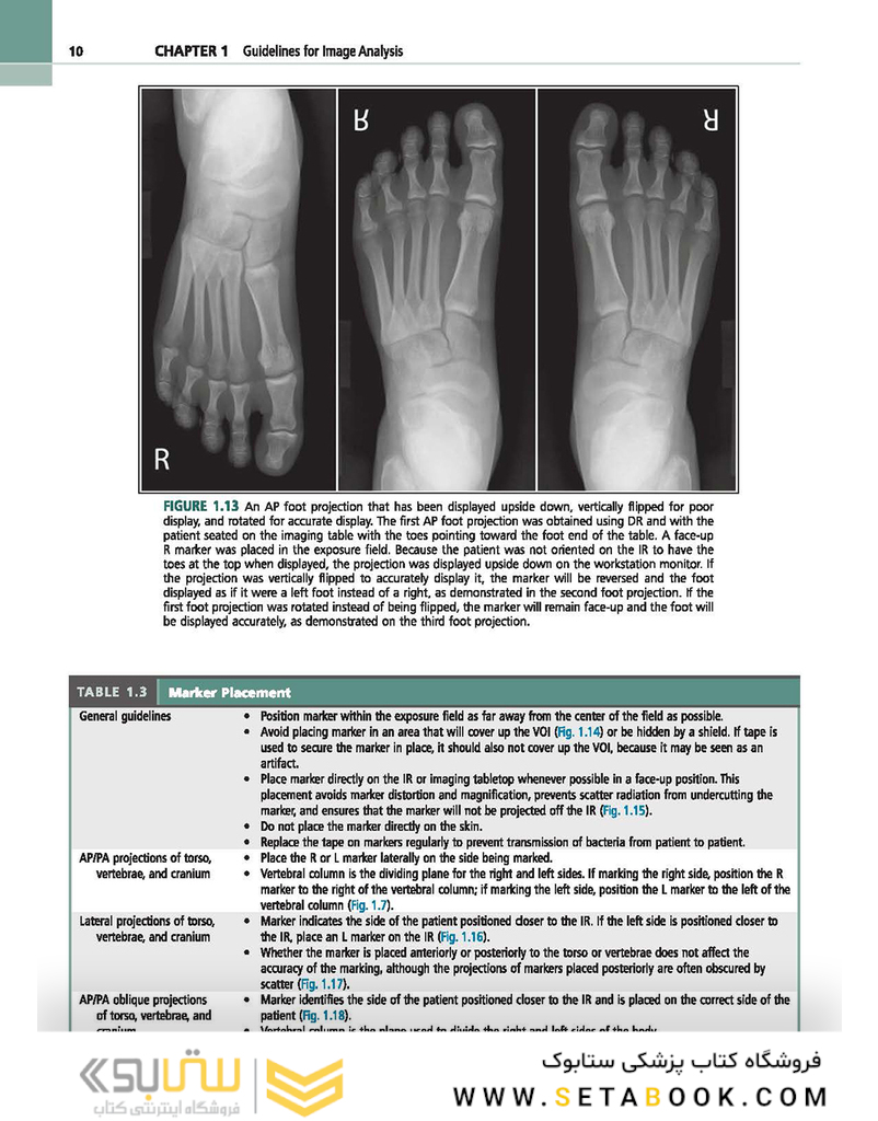 Radiographic Image Analysis