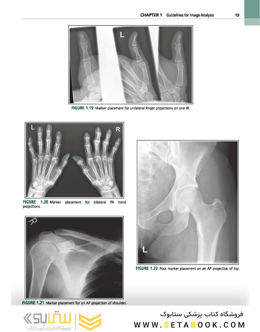 Radiographic Image Analysis