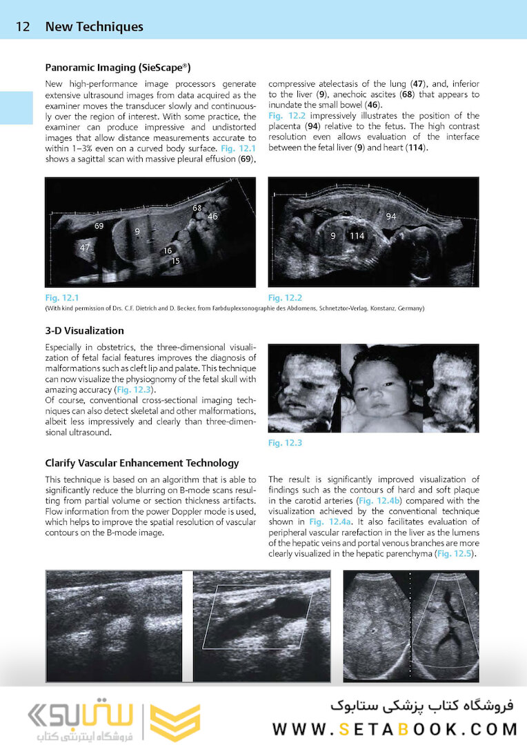 Ultrasound Teaching Manual: The Basics of Performing and Interpreting Ultrasound Scans 4th Edicion