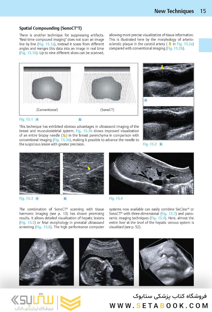 Ultrasound Teaching Manual: The Basics of Performing and Interpreting Ultrasound Scans 4th Edicion
