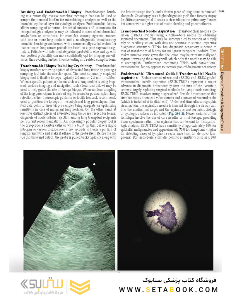 HARRISONS PRINCIPLES OF INTERNAL MEDICINE Part
