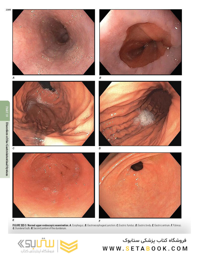 HARRISONS PRINCIPLES OF INTERNAL MEDICINE Part Disorders Of the Gastrointestinal System