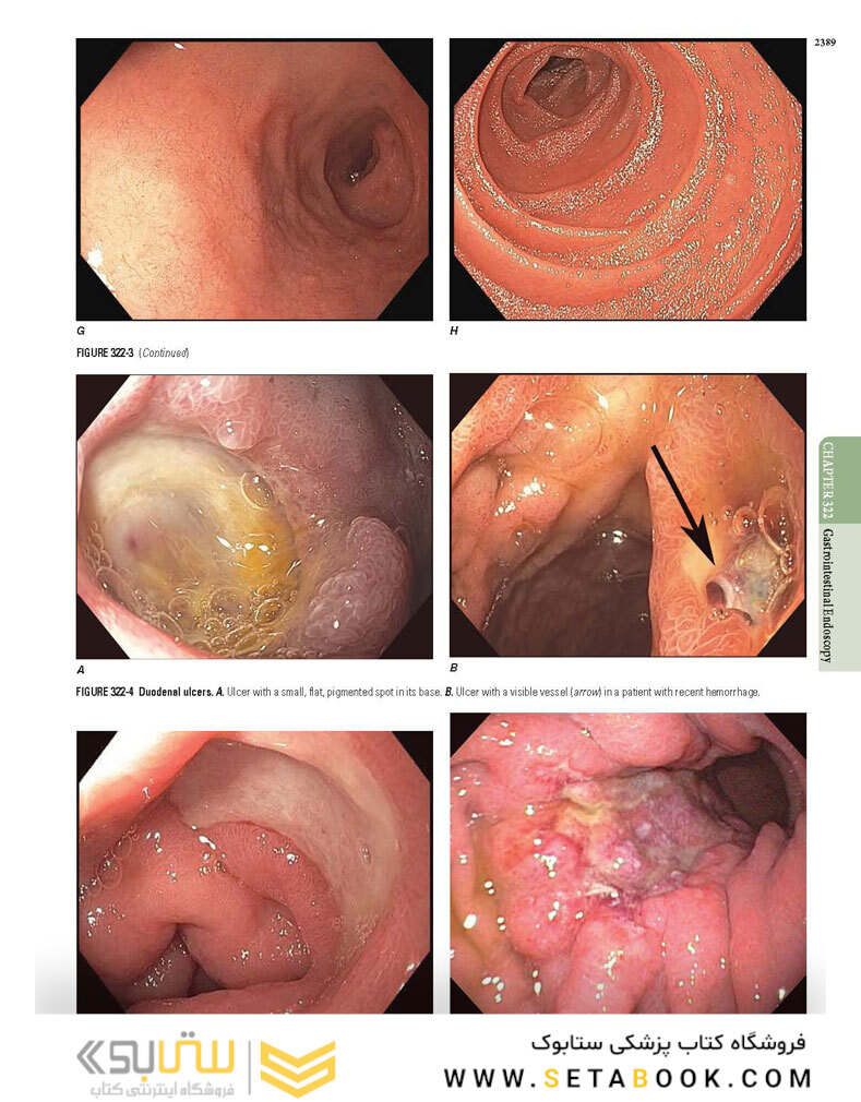 HARRISONS PRINCIPLES OF INTERNAL MEDICINE Part Disorders Of the Gastrointestinal System