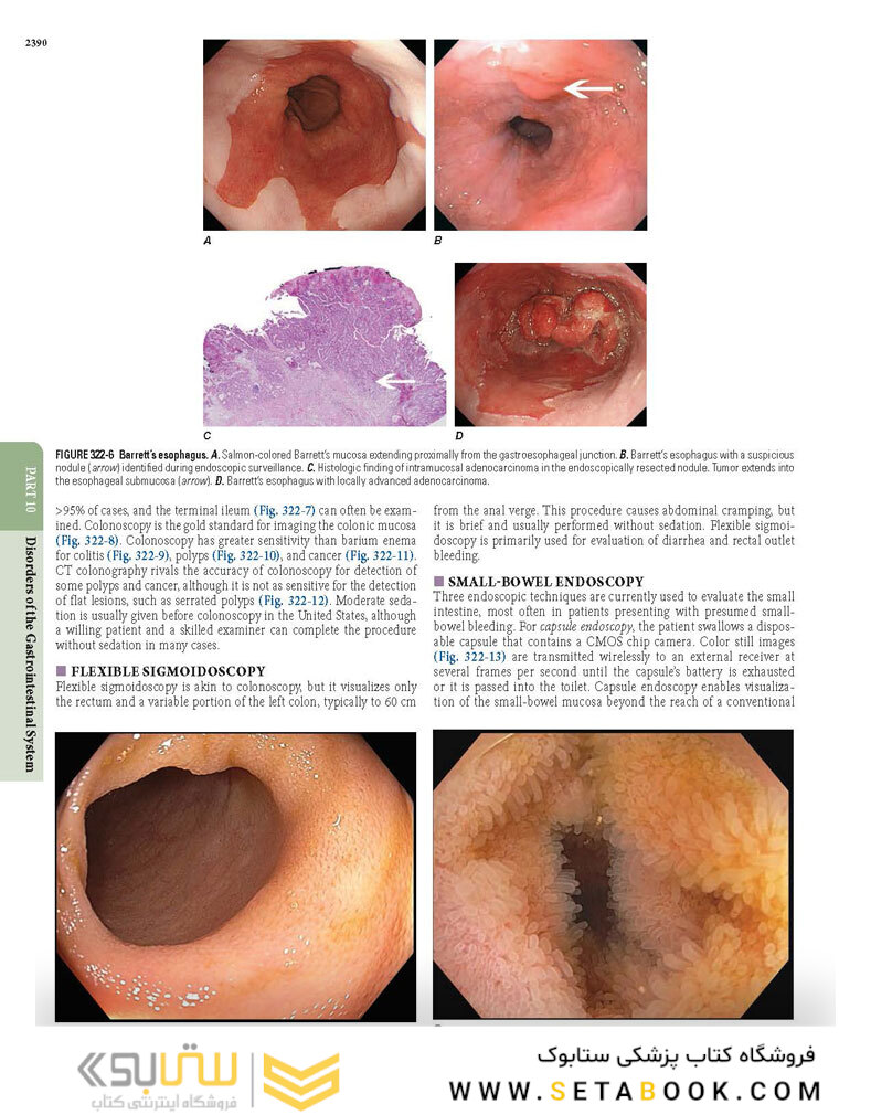 HARRISONS PRINCIPLES OF INTERNAL MEDICINE Part Disorders Of the Gastrointestinal System