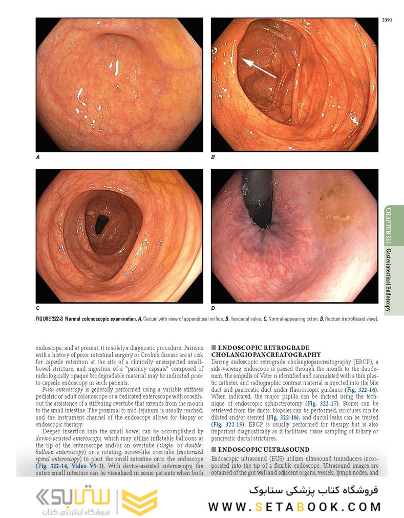 HARRISONS PRINCIPLES OF INTERNAL MEDICINE Part Disorders Of the Gastrointestinal System