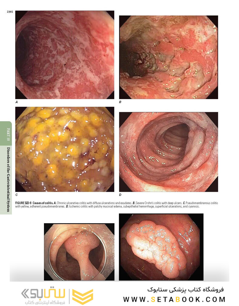 HARRISONS PRINCIPLES OF INTERNAL MEDICINE Part Disorders Of the Gastrointestinal System