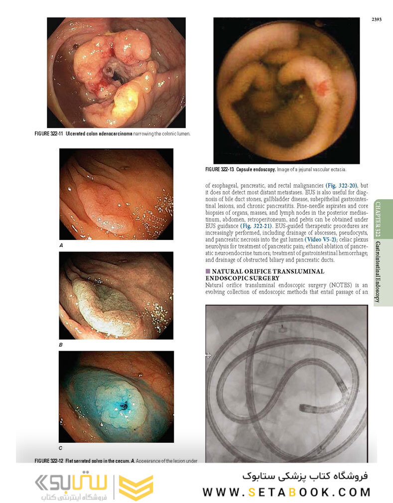 HARRISONS PRINCIPLES OF INTERNAL MEDICINE Part Disorders Of the Gastrointestinal System