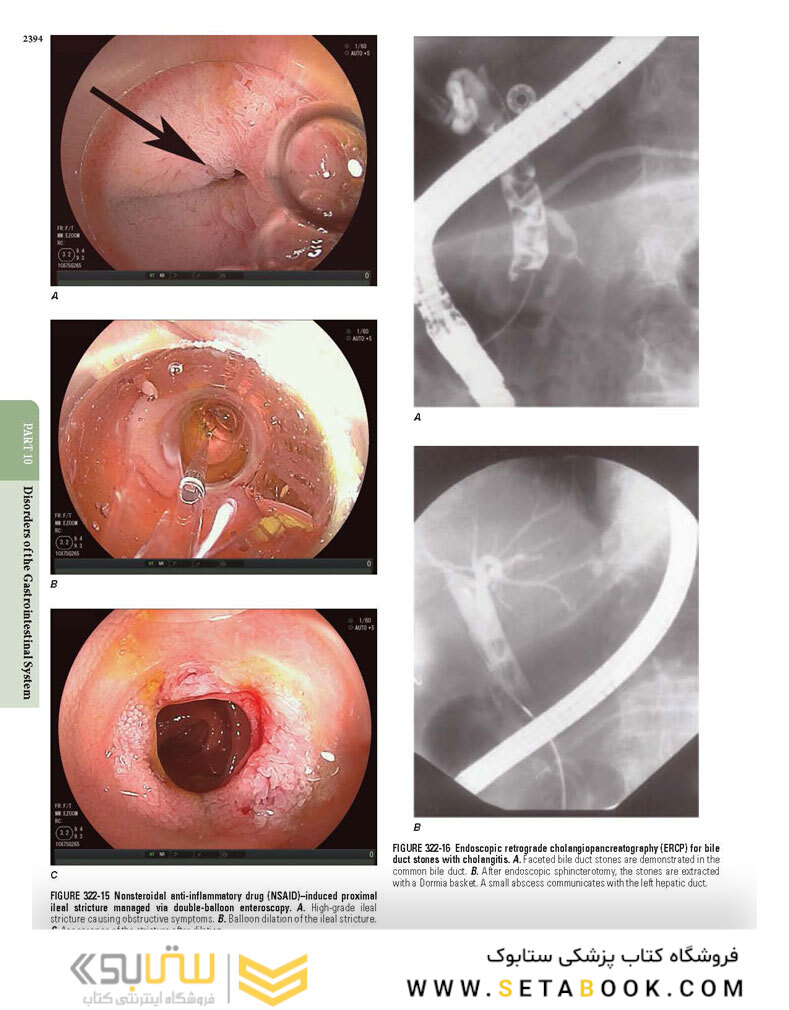 HARRISONS PRINCIPLES OF INTERNAL MEDICINE Part Disorders Of the Gastrointestinal System