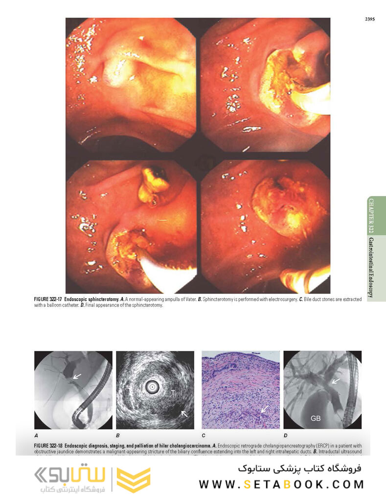 HARRISONS PRINCIPLES OF INTERNAL MEDICINE Part Disorders Of the Gastrointestinal System