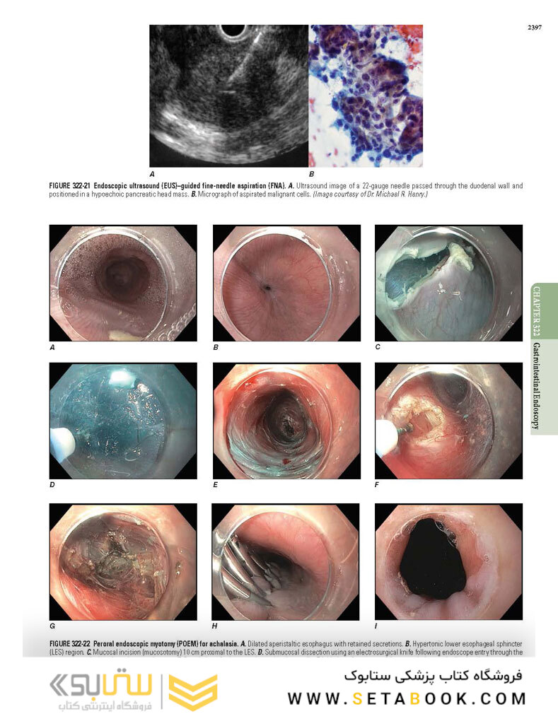 HARRISONS PRINCIPLES OF INTERNAL MEDICINE Part Disorders Of the Gastrointestinal System