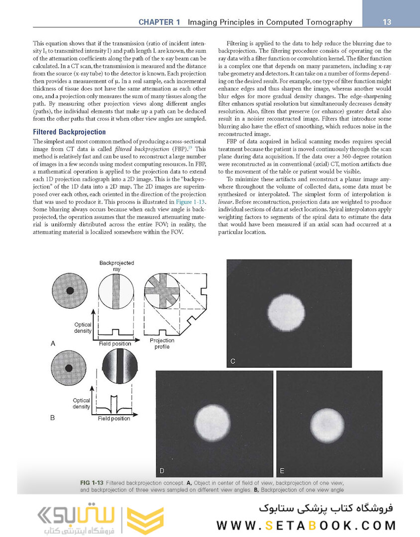 CT and MRI of the Whole Body, 2-Volume Set