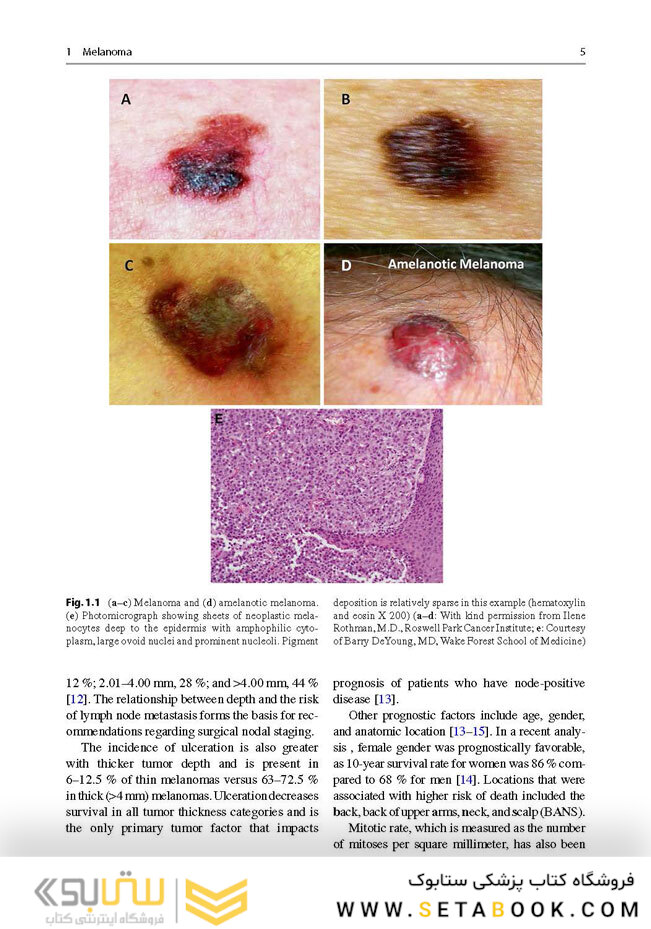 Surgical Oncology : A Practical and Comprehensive Approach 2016
