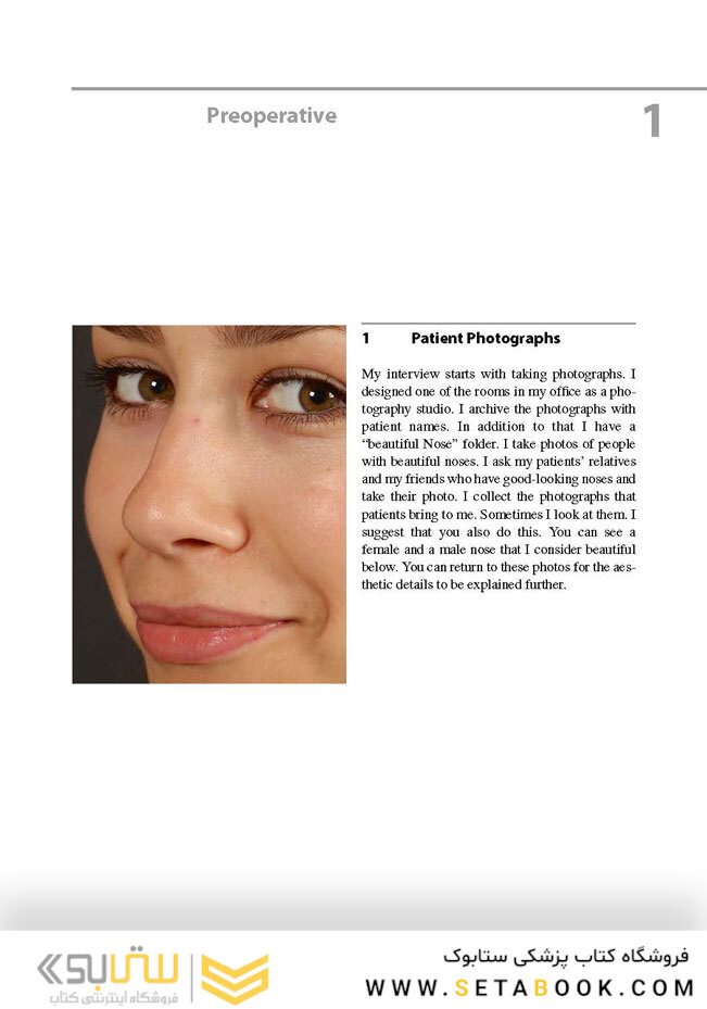 Aesthetic Septorhinoplasty2016سپتورینوپلاستی زیبایی