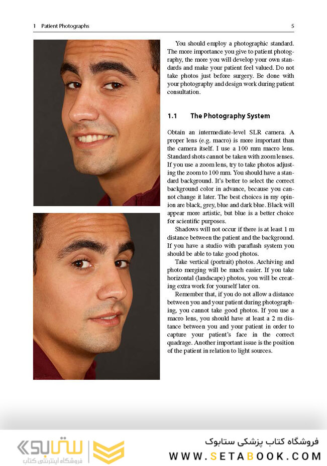 Aesthetic Septorhinoplasty2016سپتورینوپلاستی زیبایی