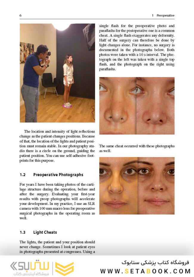 Aesthetic Septorhinoplasty2016سپتورینوپلاستی زیبایی