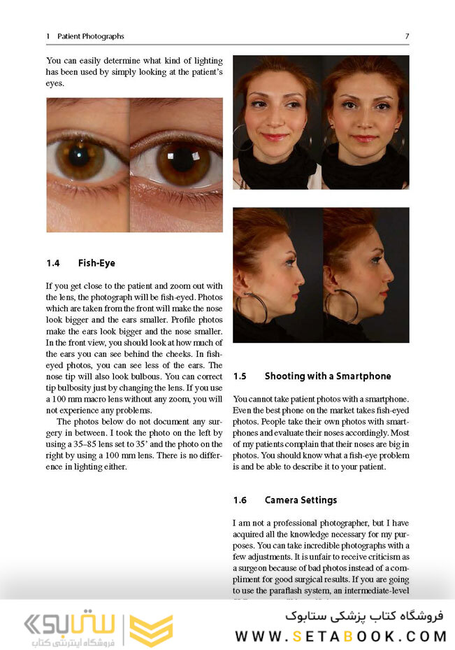 Aesthetic Septorhinoplasty2016سپتورینوپلاستی زیبایی