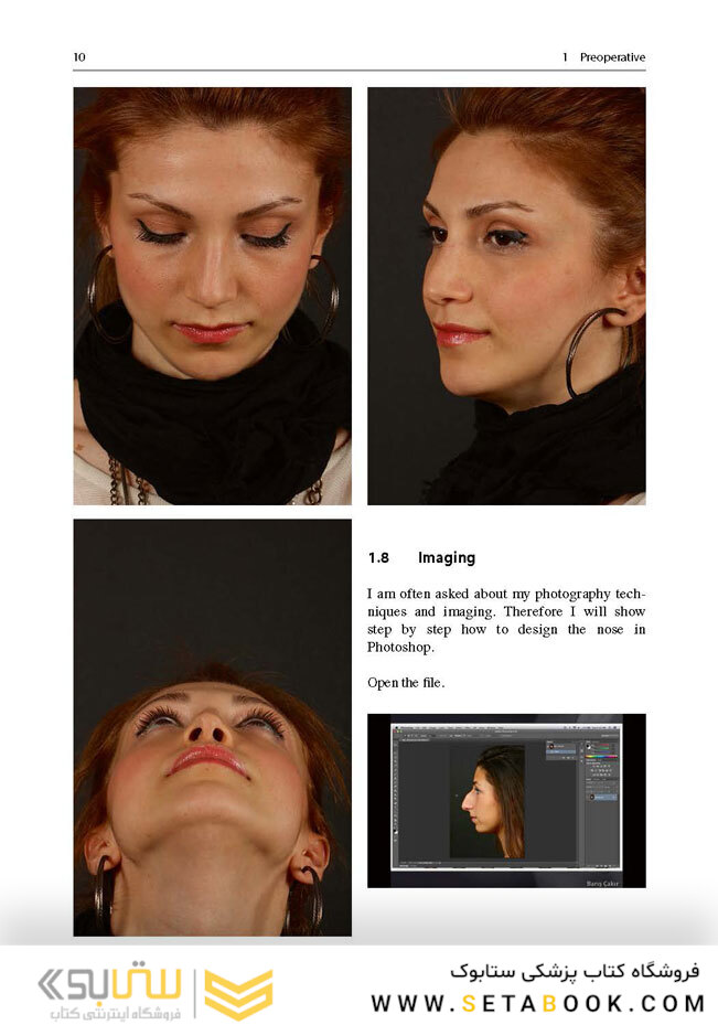 Aesthetic Septorhinoplasty2016سپتورینوپلاستی زیبایی