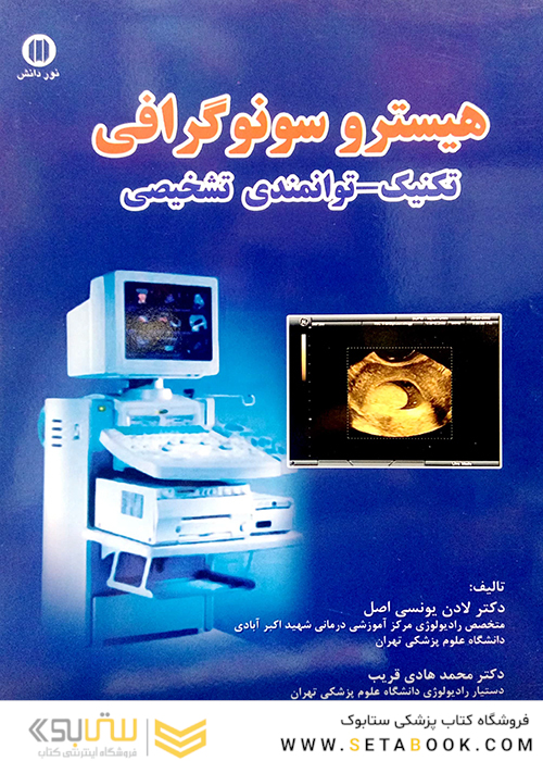 هیسترو سونوگرافی