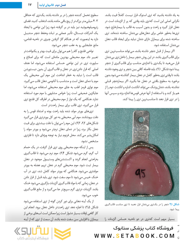 درمان بیماران با دنچر کامل 2020