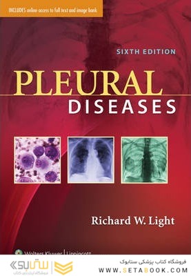 Pleural Diseases