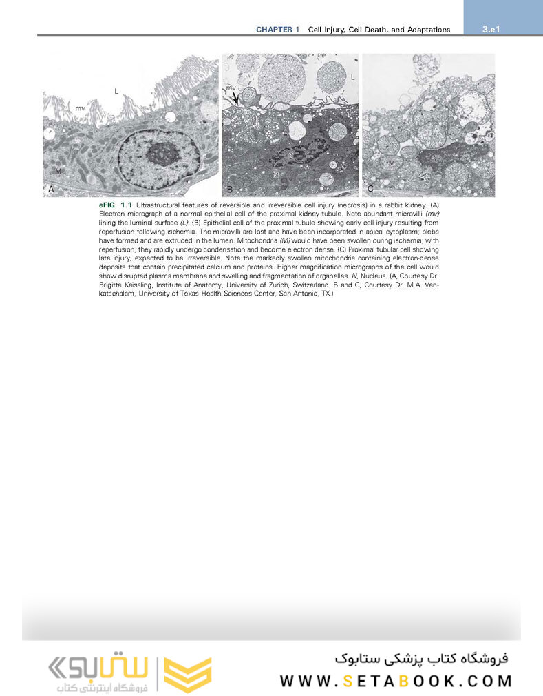 Robbins - Kumar Basic Pathology 11th Edicion