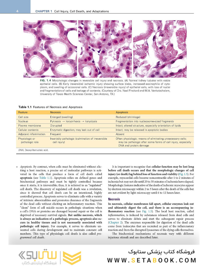 Robbins - Kumar Basic Pathology 11th Edicion