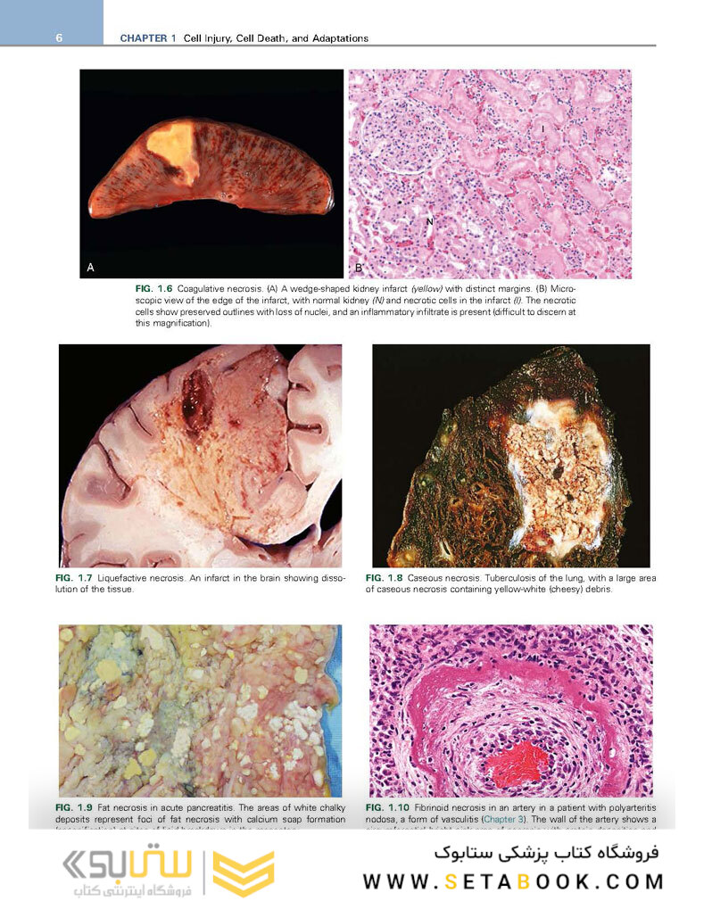 Robbins - Kumar Basic Pathology 11th Edicion