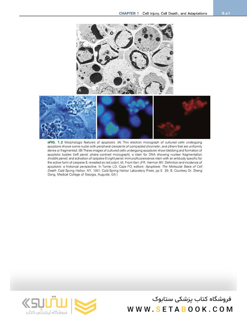 Robbins - Kumar Basic Pathology 11th Edicion