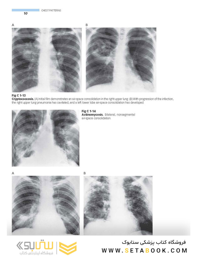Clinical Imaging: An Atlas of Differential Diagnosis Fifth Edition