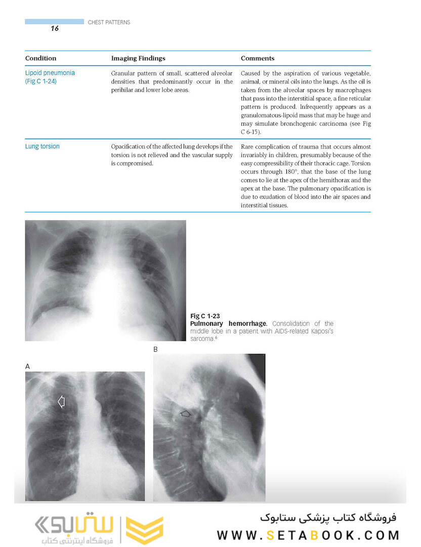 Clinical Imaging: An Atlas of Differential Diagnosis Fifth Edition
