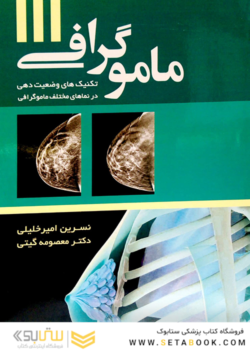 ماموگرافی تکنیک های وضعیت دهی در نماهای مختلف ماموگرافی