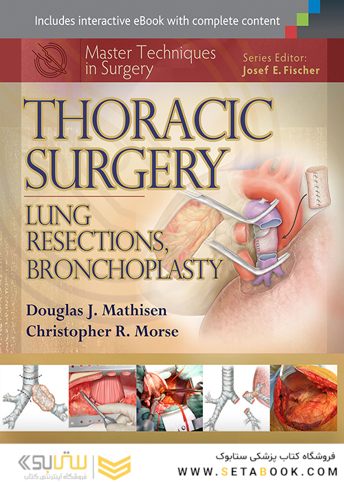 کتاب Master Techniques in Surgery: Thoracic Surgery: Lung Resections, Bronchoplasty