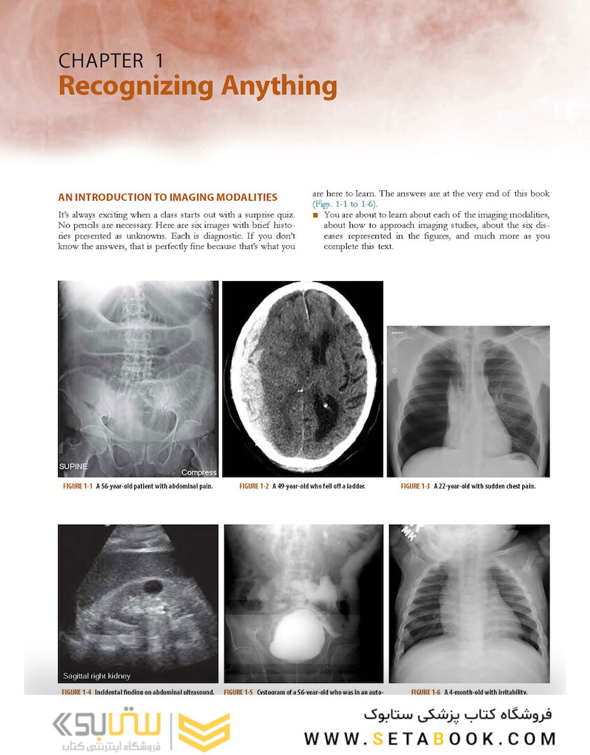 Learning Radiology: Recognizing the Basics