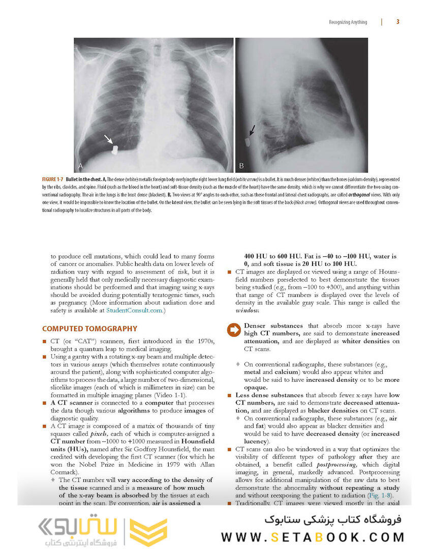 Learning Radiology: Recognizing the Basics